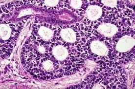 EXAME ANÁTOMO-PATOLÓGICO